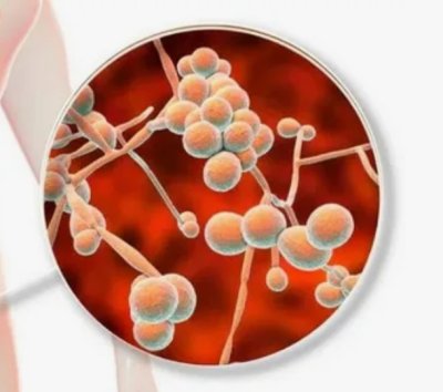 Мой опыт лечения вагинита: какие методы оказались наиболее эффективными